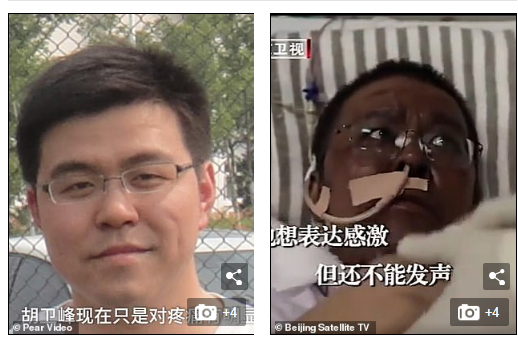 JUST IN: Wuhan Doctor whose Skin turns dark due to COVID-19 Dies -[PHOTOS]