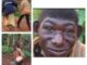 See The 21 Years Old Man Born As Human With The Features Of A Chimpanzee -[SEE PHOTOS]