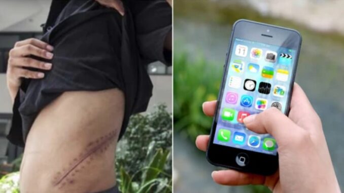 Teenager Sold His Kidney To Buy iPhone, But What Happen Next Melts Heart -[CHECK OUT]