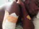 75353972 Sad News As Man Arm Cut-off After Police Assault -[SEE PHOTOS]